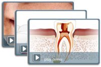 Dental Animations