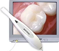 Intraoral Camera